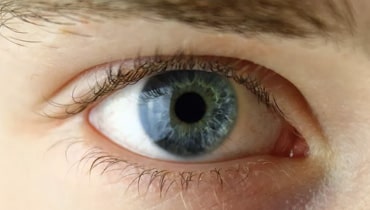 O que é Glaucoma?