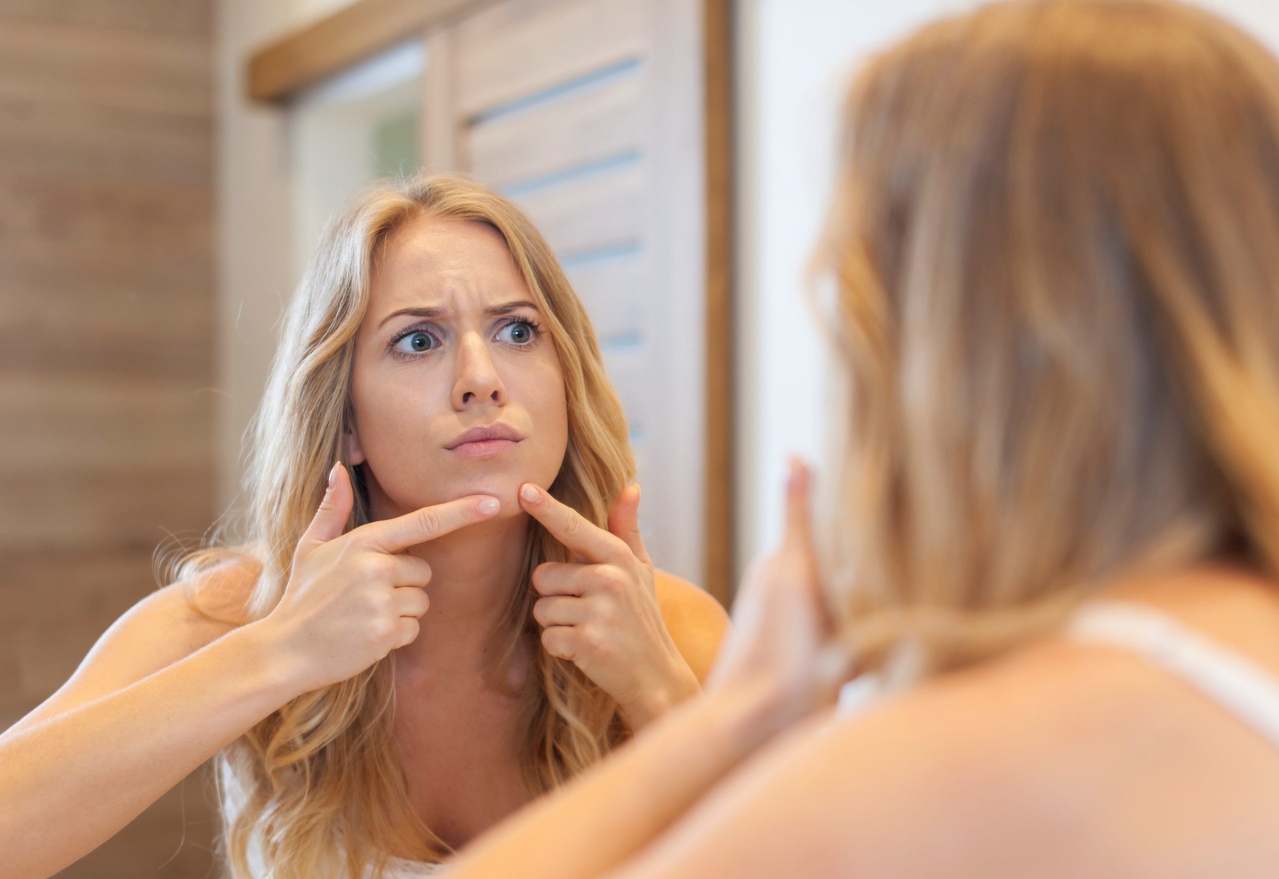 Entenda de uma vez por todas: O que causa acne?