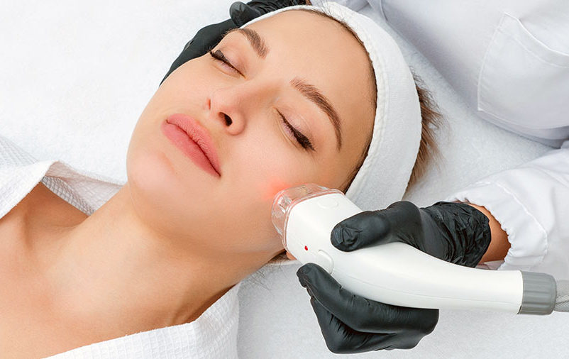 Laser Lavieen: O procedimento que pode rejuvenescer sua pele