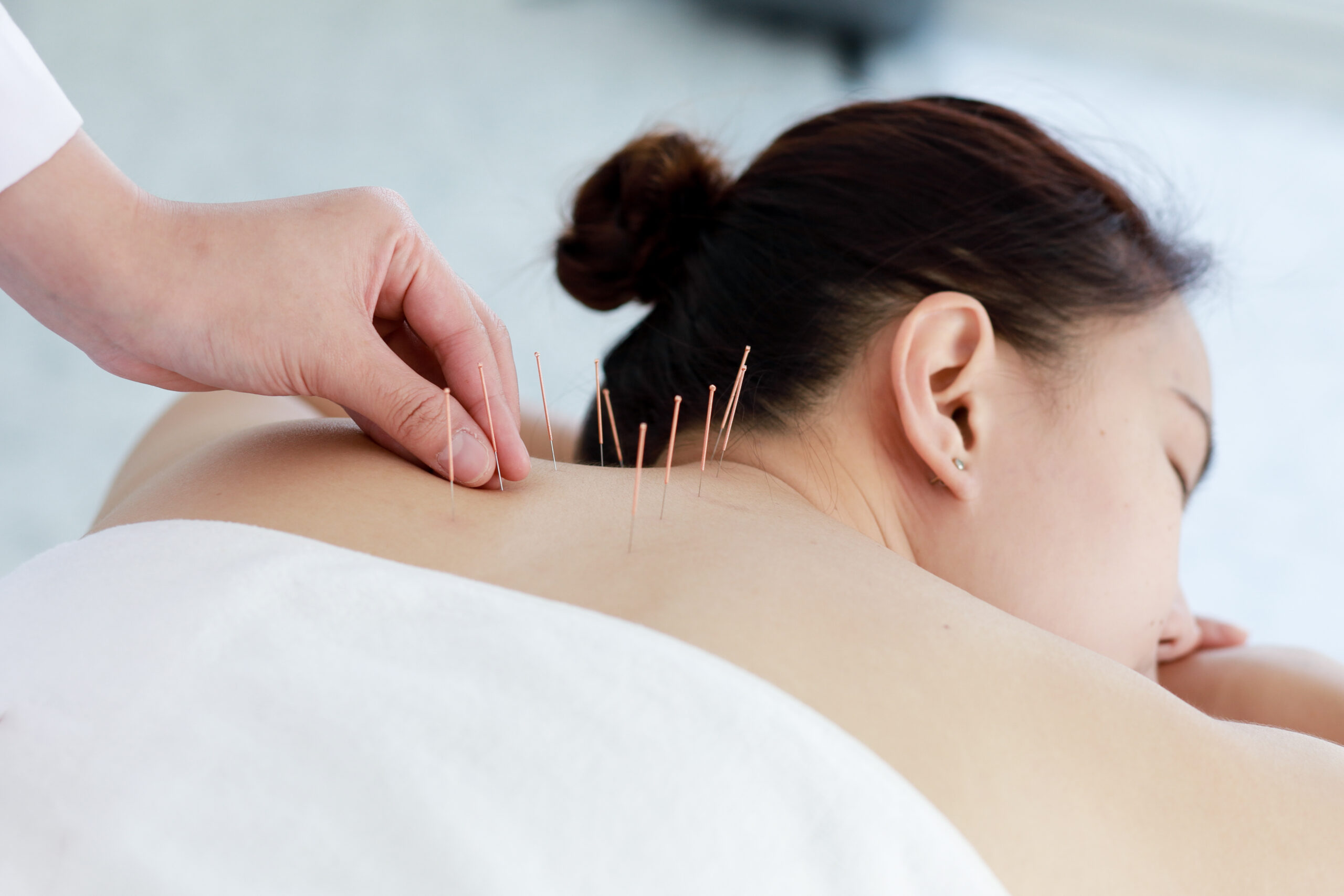 Você sente dor no ombro? A acupuntura pode te ajudar!